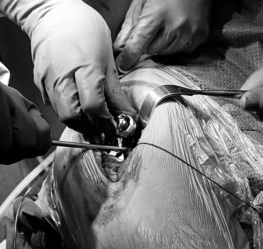 Equipo médico durante un procedimiento quirúrgico